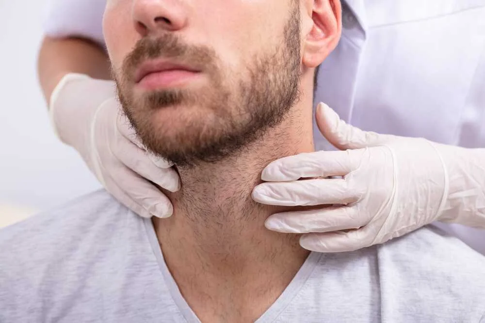 beard transplant