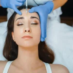 Collagen Biostimulator Injections